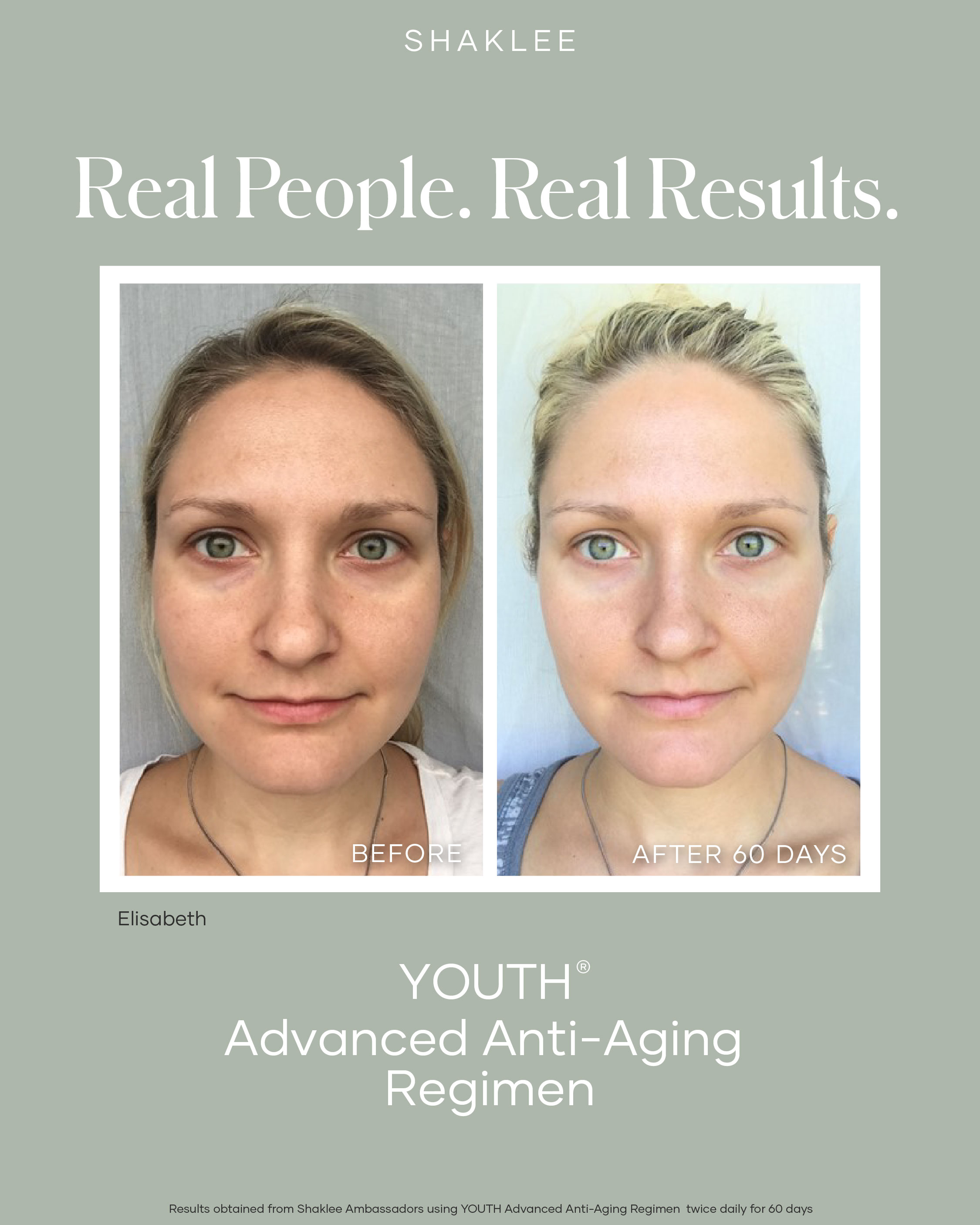 Before and after using the YOUTH Advanced Anti-Aging Regimen for 60 days