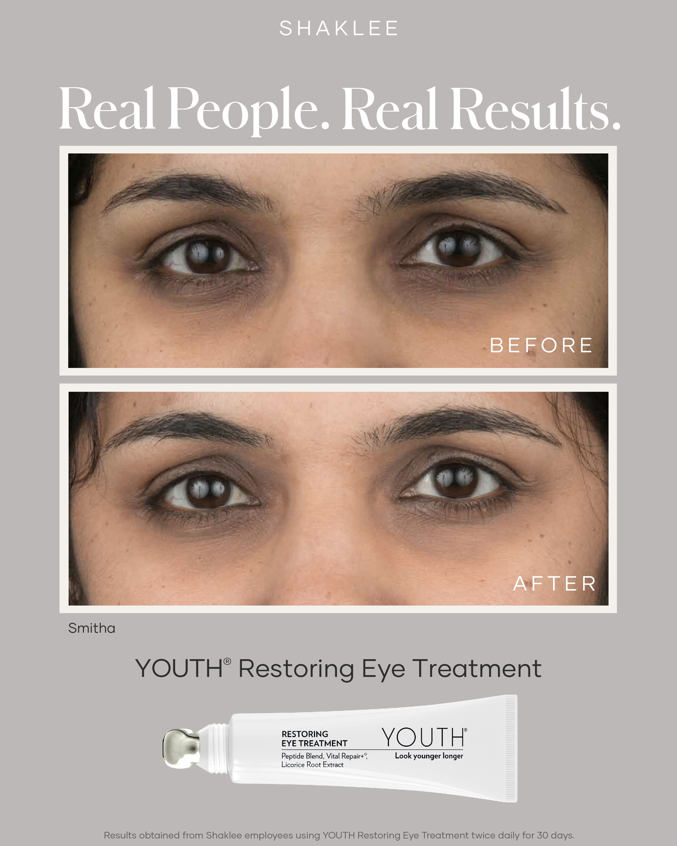 Before and after using YOUTH Restoring Eye Treatment